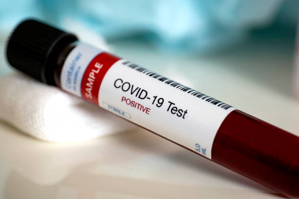 Blood test samples for presence of coronavirus (COVID-19) Blood test samples for presence of coronavirus (COVID-19) tube containing a blood sample that has tested positive for coronavirus. test tube stock pictures, royalty-free photos & images