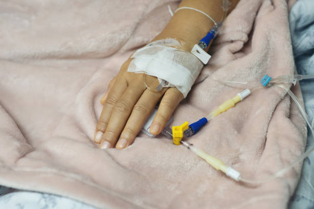 Blurry of Saline intravenous drip on hand on bed in hospital background Blurry of Saline intravenous drip on hand on bed in hospital background. Health care and Medical equipment concept. infusion therapy stock pictures, royalty-free photos & images