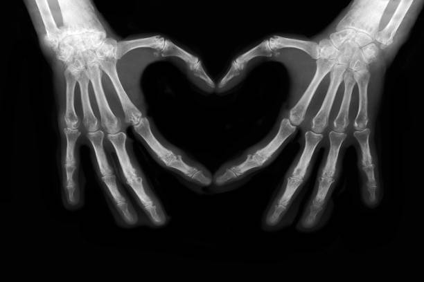Bones of hands Bones of hands making the sign of love xray stock pictures, royalty-free photos & images