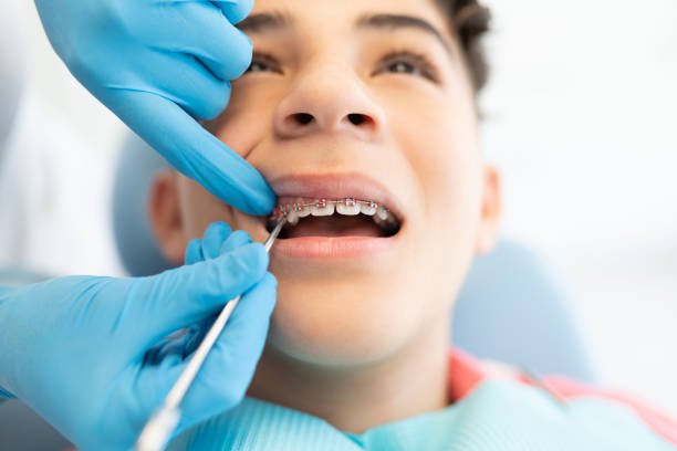 Boy Visiting Dental Clinic For Treatment Of Braces Latin teenage boy with dentist adjusting new elastic bands on braces braces rubber bands stock pictures, royalty-free photos & images