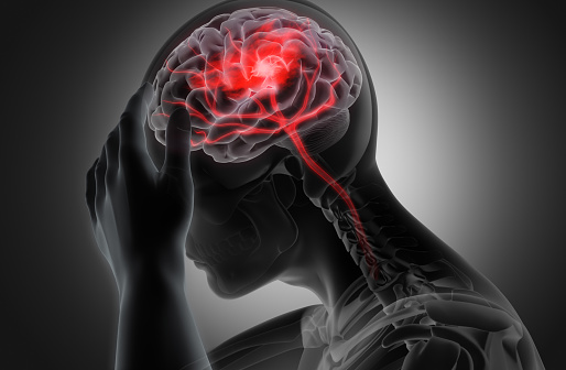 Man with heavy headache or brain stroke - conceptual artwork - 3d illustration - Gray scale Image