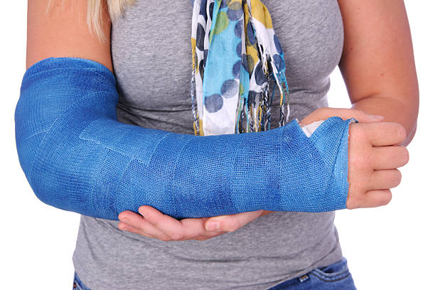 Gebrochen gips arm Moppis Blog Gebrochen gips arm gips arm