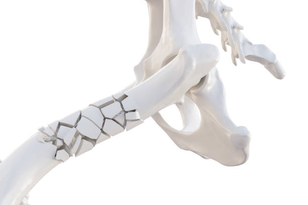 Broken dog femur bone with visible other bones Broken dog femur bone with visible other bones. Canine skeleton 3d illustration, isolated over white animal bone stock pictures, royalty-free photos & images