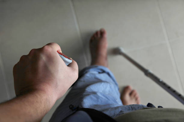 Broken leg operated and removed cast, pov stock photo