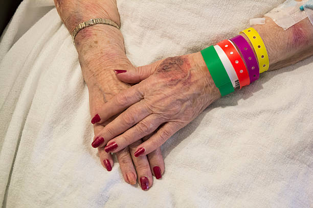 Bruised Hands of Elderly Woman in Emergency Room stock photo