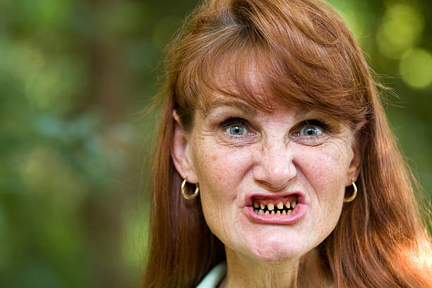 Rotten woman teeth with rotten teeth: