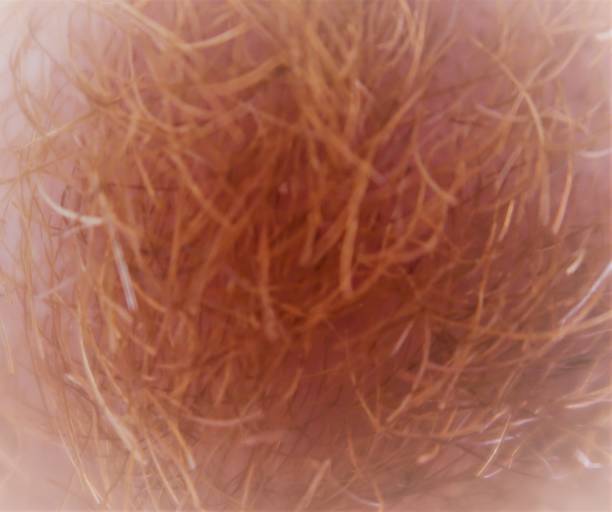 Capillary fibers Grenoble, France – June 22, 2018: photography showing some capillary fibers. macro body hair stock pictures, royalty-free photos & images
