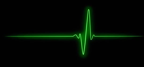 Cardiogram, hope for survival, resuscitation of human life, pulse. Ekg - Heart beat.  pulse trace stock pictures, royalty-free photos & images