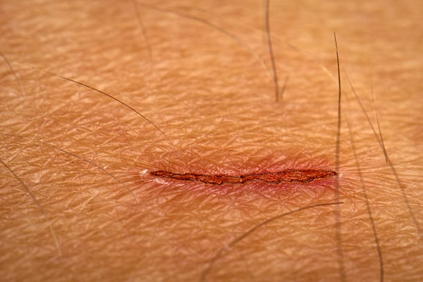 Cat's Scar on man's Leg. Kitten scratch marks macro shot. macro body hair stock pictures, royalty-free photos & images