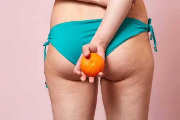 cellulite of a young girl in a blue swimsuit with an orange in her hands . on a pink isolated background stock photo