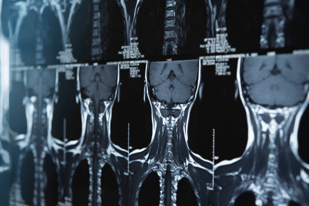 cervicale wervelkolom x-ray beelden - hoofd stockfoto's en -beelden