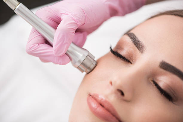 Charming lady is getting cosmetic treatment in spa Close up of instrument in hand of doctor-cosmetologist, which is making procedure microdermabrasion of facial skin for beautiful young woman at beauty salon. Girl is lying with closed eyes beauty treatment stock pictures, royalty-free photos & images