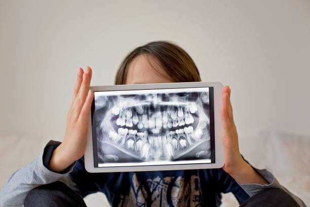 Child, preteen boy, holding tablet with a picture of his x-ray teeth stock photo