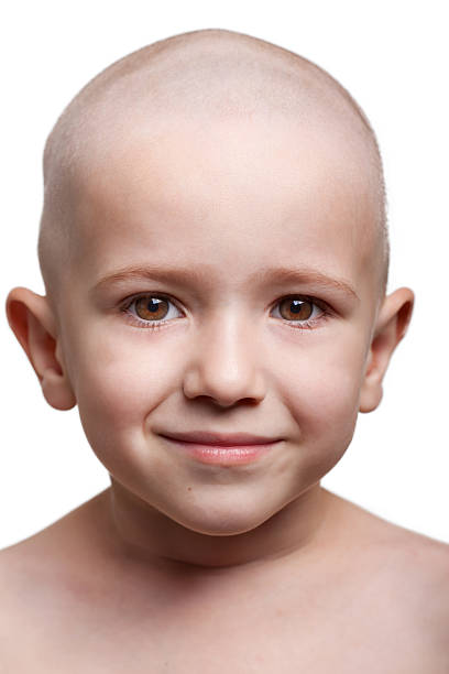 Child who has lost their hair smiling stock photo
