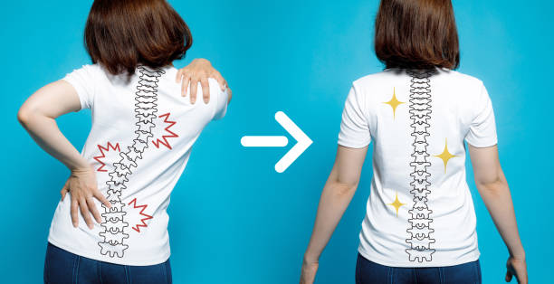 chiropractic before after image. from bad posture to good posture. woman's body and backbone. chiropractic before after image. from bad posture to good posture. woman's body and backbone. standing posture stock pictures, royalty-free photos & images