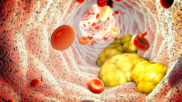 Cholesterol formation, fat, artery, vein, heart. Red blood cells, blood flow stock photo