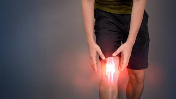 Close up man leg is pain knee pain Close up man leg is pain knee pain human knee stock pictures, royalty-free photos & images