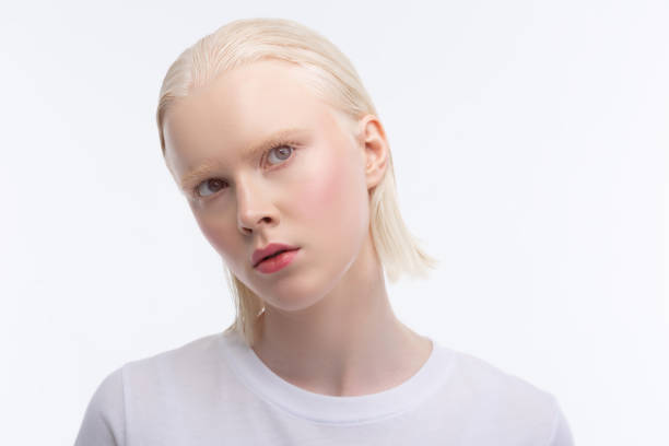 3,100 Albino Woman Stock Photos, Pictures & Royalty-Free Images - iStock