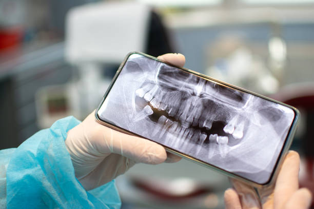 Close up of dentist's hands in protective gloves holding mobile smart phone showing patient's Dental X-ray stock photo