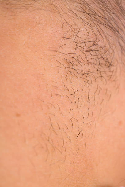 Close up of human skin Close up photo of human hairy skin macro body hair stock pictures, royalty-free photos & images