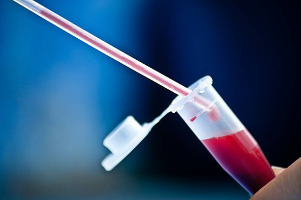 close up of pipette with Blood in sample tube stock photo