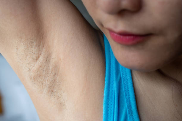 Close up of woman showing her unshaved armpit. Unshaven women often meet other criteria for traditional feminine beauty. ugly girl stock pictures, royalty-free photos & images