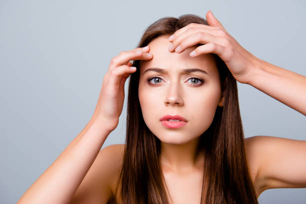 Close up portrait of frustrated sad upset beautiful young woman is squeezing out pimples on her forehead, isolated on grey background Close up portrait of frustrated sad upset beautiful young woman is squeezing out pimples on her forehead, isolated on grey background imperfection stock pictures, royalty-free photos & images