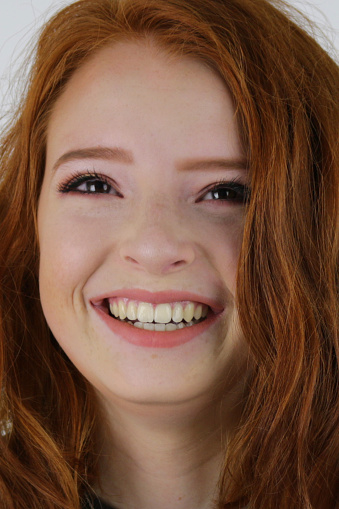 Portrait Beautiful Girl Freckles Closeup Stock Photo 