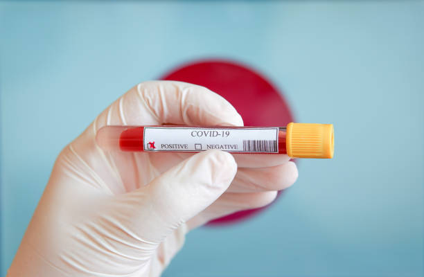Close-up of a Positive COVID-19 blood test sample tube with Flag of Japan at background. stock photo