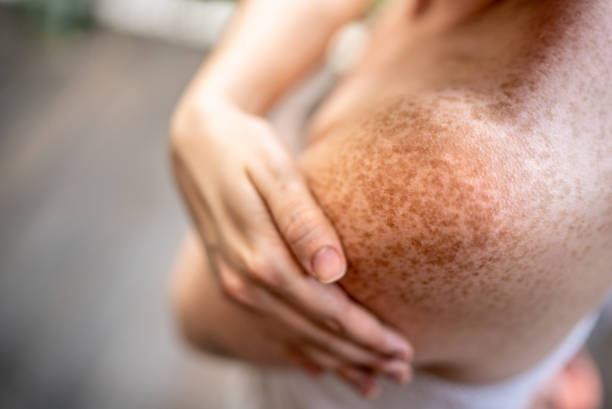 Close-up of a shoulder of a adult woman at spa stock photo