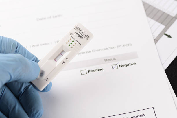 Close-up of negative result by rapid antigen test for SARS-CoV-2, COVID-19 stock photo