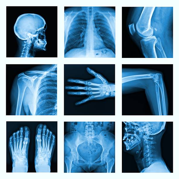 Collage of many X-rays in very good quality. stock photo