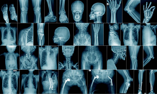 collection x-ray multiple area high quality x-ray collection body part and fracture area human skeleton photos stock pictures, royalty-free photos & images