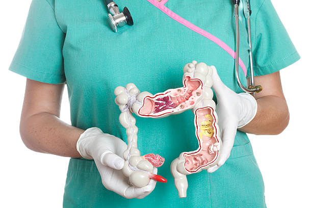 Colon Female nurse holding anatomical model of human colon with pathologies. The model shows appendicitis, cancer, Crohn’s disease, spastic colon, ulcerative colitis, polyps, diverticulosis, diverticulitis, bacterial infection and adhesions. colon stock pictures, royalty-free photos & images