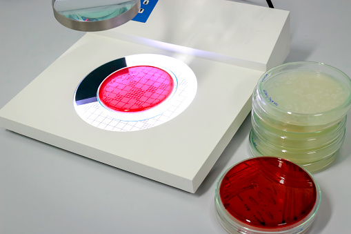 Contador De Colonias Y Fluido En Cristalería De Placa Sin Petri Con  Cultivos Crecientes De Microorganismos