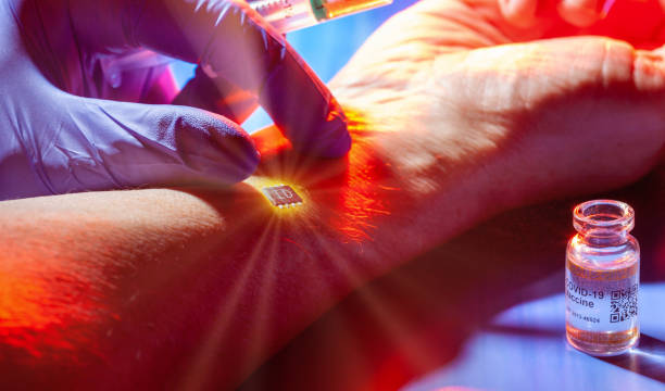 Conspiracy theory concept with identification chip being implanted in patient's arm during COVID-19 vaccination stock photo