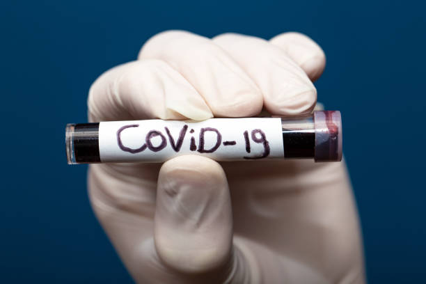 convid-19 bloedmonster, arts met medische handschoenen met een bloedbuis met positief coronavirus 2019-ncov bloedmonster. - coronatest netherlands stockfoto's en -beelden