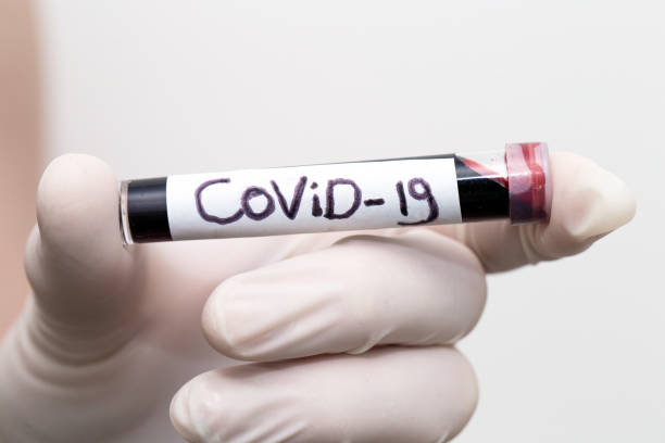 convid-19 bloedmonster, arts met medische handschoenen met een bloedbuis met positief coronavirus 2019-ncov bloedmonster. - coronatest netherlands stockfoto's en -beelden
