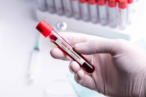 Coronavirus Blood Sample Doctor wearing medical gloves holding a blood tube with positive Coronavirus 2019-nCoV Blood Sample. blood testing stock pictures, royalty-free photos & images