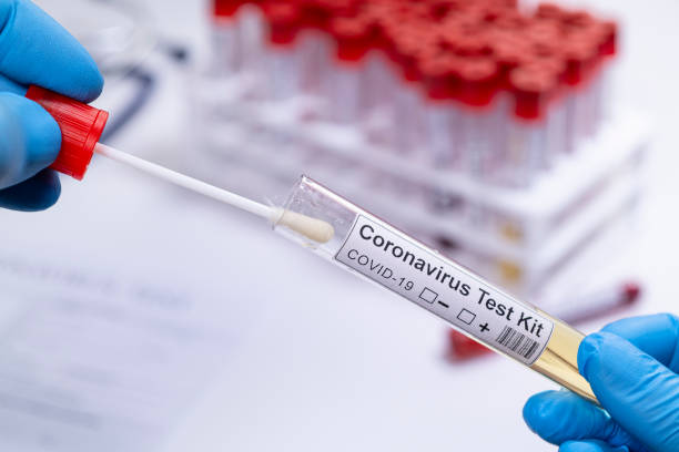 coronavirus covid 19 test neuartige corona-virus medizinisches labor proben - corona test stock-fotos und bilder