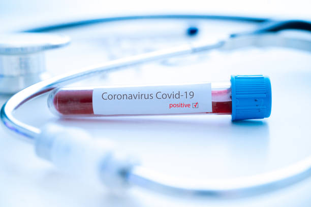 coronavirus covid-19 breekt. geneeskunde en epidemisch concept. buis met positief bloedtestresultaat, beschermend gezichtsmasker, medicijnpillen, stethoscoop, flacon en spuit, vaccin in laboratorium - coronatest netherlands stockfoto's en -beelden