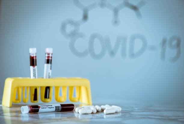 Coronavirus disease (COVID-19) - treatment ideas stock photo