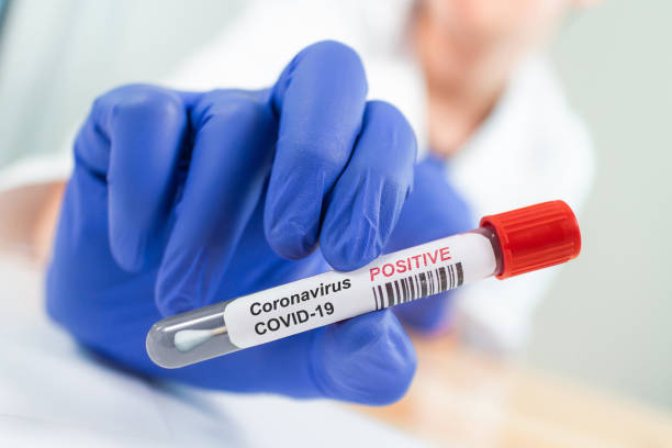probówka zarażonym wieńcem coronavirus - covid test zdjęcia i obrazy z banku zdjęć