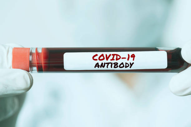Covid-19 Antibody Male doctor is showing Coronavirus Antibody blood sample tube. The blood of healed coronavirus patients will be used for treatment. antibody photos stock pictures, royalty-free photos & images