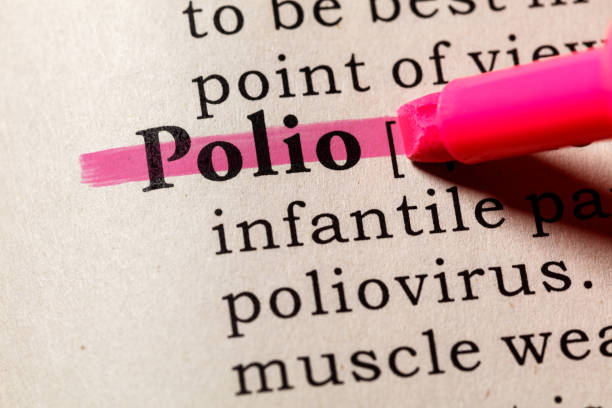 소아마비의 정의 - polio 뉴스 사진 이미지