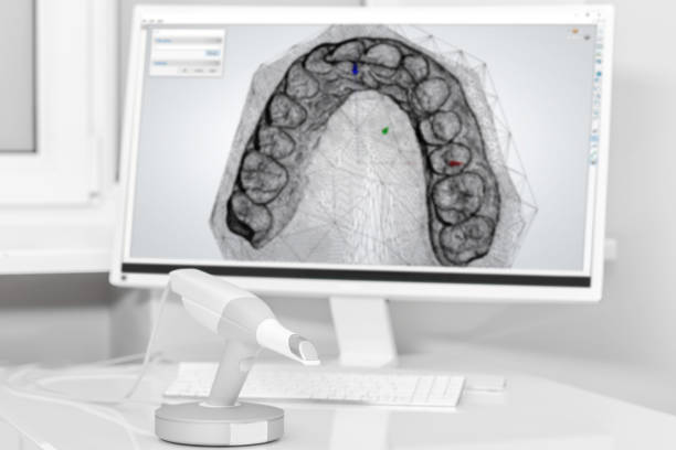 Dental 3d scanner and monitor in the dentist's office stock photo