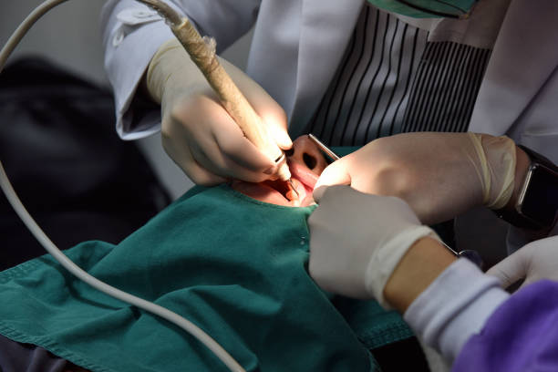 Dental care check up, Dentist examining and doing teeth treatment in dental clinic, Yearly visit for teeth cleaning and scaling to prevent gum disease problems, Healthy oral hygienic. stock photo