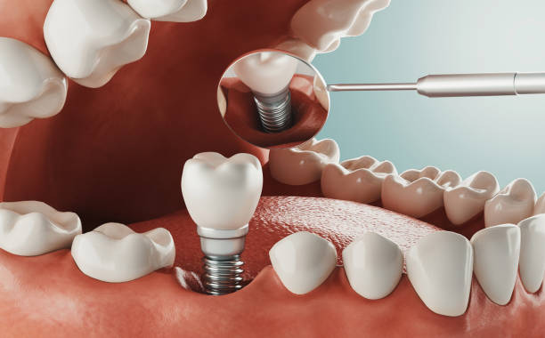 Dental care, modern clinic, 3d rendering stock photo