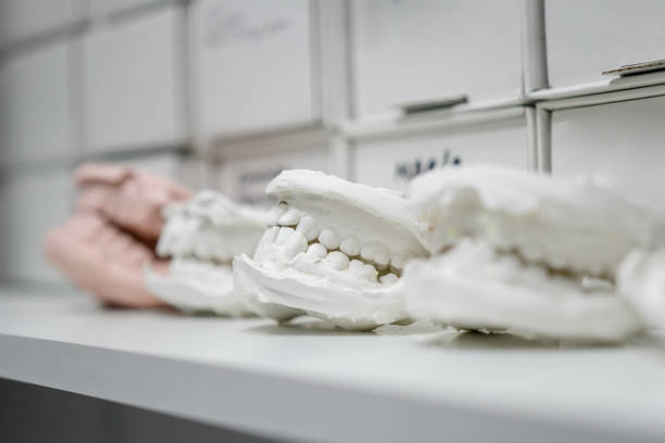 Dental casting gypsum model plaster cast stomatologic human jaws prothetic laboratory, technical shots stock photo
