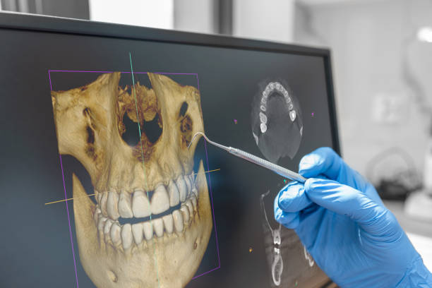 zahnärztliche beratung mit 3d-tomographiebild - zahnarztausrüstung stock-fotos und bilder